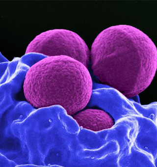 Infectious Diseases A–Z