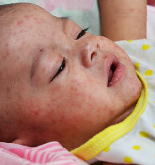 Highlighted Infectious Diseases for Arizona